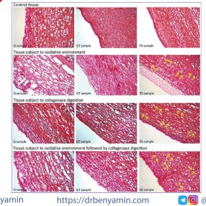 تحليل Picrosirius red staining