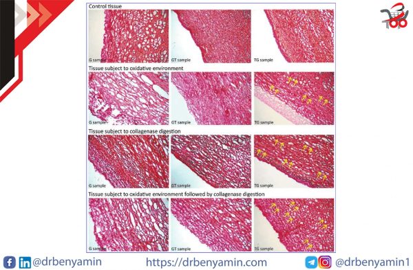 تحليل Picrosirius red staining