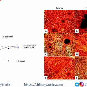 تحليل Alizarin red staining