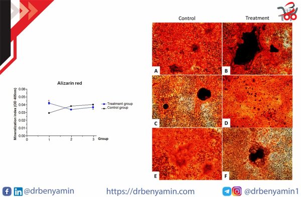 تحليل Alizarin red staining