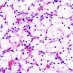 تحليل Hematoxylin and Eosin stain H&E