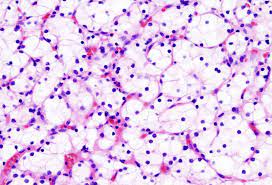 تحليل Hematoxylin and Eosin stain H&E