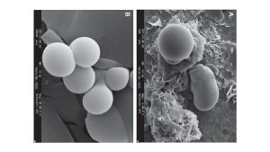 تخليق الجسيمات النانوية الشحمية / Liposome