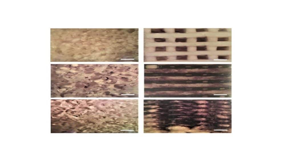 staining by BCP/NBIT