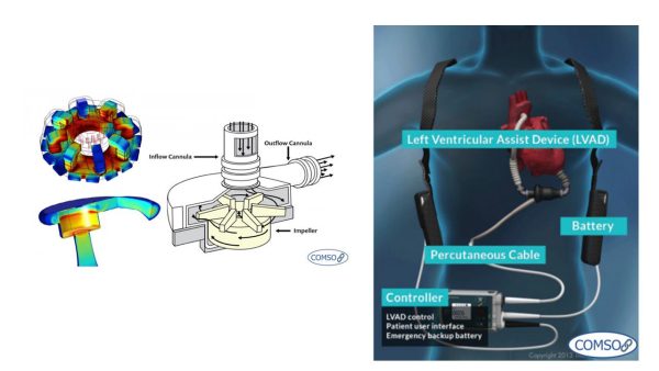 (Left Ventricular Assist Devices) أجهزة مساعدة البطين الأيسر