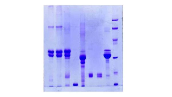 الرحلان الكهربائي للبروتين Protein Electrophoresis