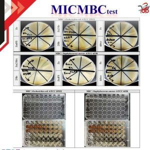 اختبار مضاد للبكتيريا لتحديد MIC و MBC